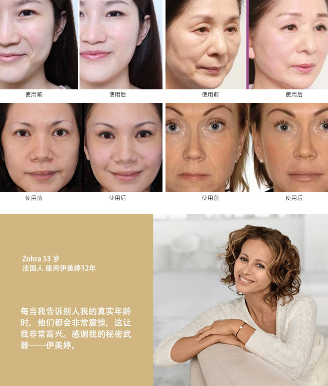 Imedeen胶原蛋白全线82折，含套装哦~